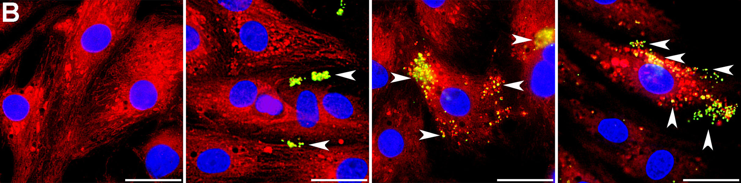 Microscopic images show mitochondria that have been transpanted into rat heart tissue entering the cells.