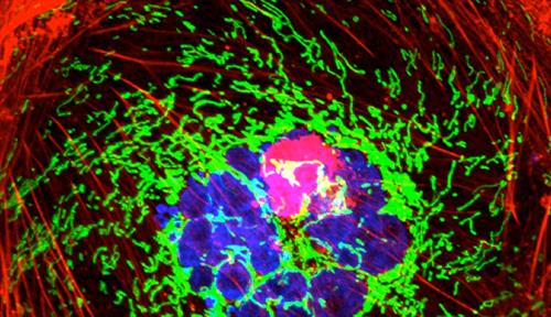 Micrograph shows a polyploid giant cancer cell (PGCC) from a triple-negative breast cancer. Actin is red; mitochondria are green; nuclear DNA is blue.