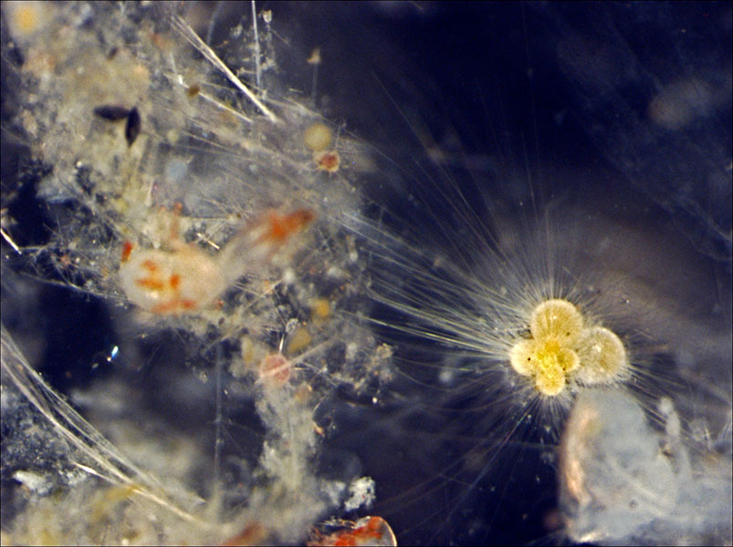 A photograph of a living foraminiferan shows its shape — it looks like a series of globe-like structures stuck together. Also visible are the thin tentacle-like structures that extrude from holes in its shell quite a distance.