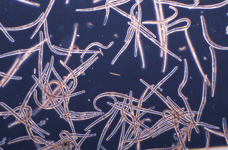 Long, skinny microbes populate a microscope field.