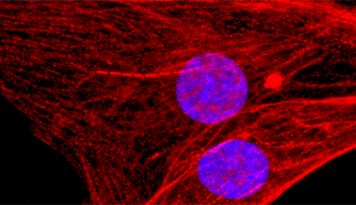 Photograph of heart muscle cells seen under the microscope.