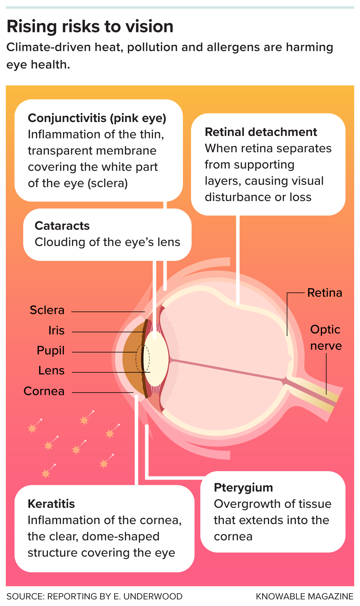 Side view diagram of an eye with labeled anatomy, alongside a list of eye conditions linked to climate-driven heat, pollution, and allergens